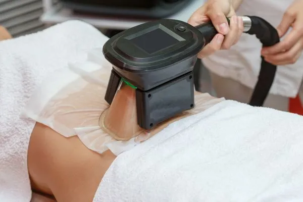 Image of person having fat freezing treatment to help weight gain Devizes