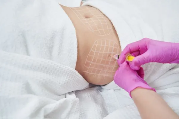 image of fat dissolving injections on love handles to help combat weight gain Devizes