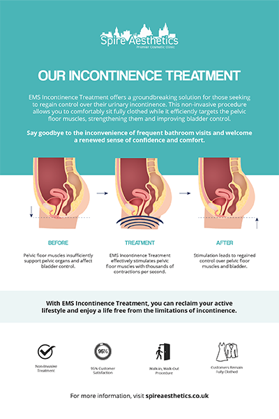 image of how urge incontinence Devizes treatment works
